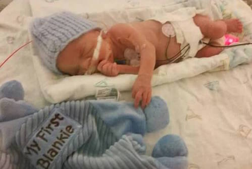 Like many premature babies, Keegan's lungs were underdeveloped at birth, and he suffers from a chronic lung disease. Courtesy photo: Addie Mack Herzog